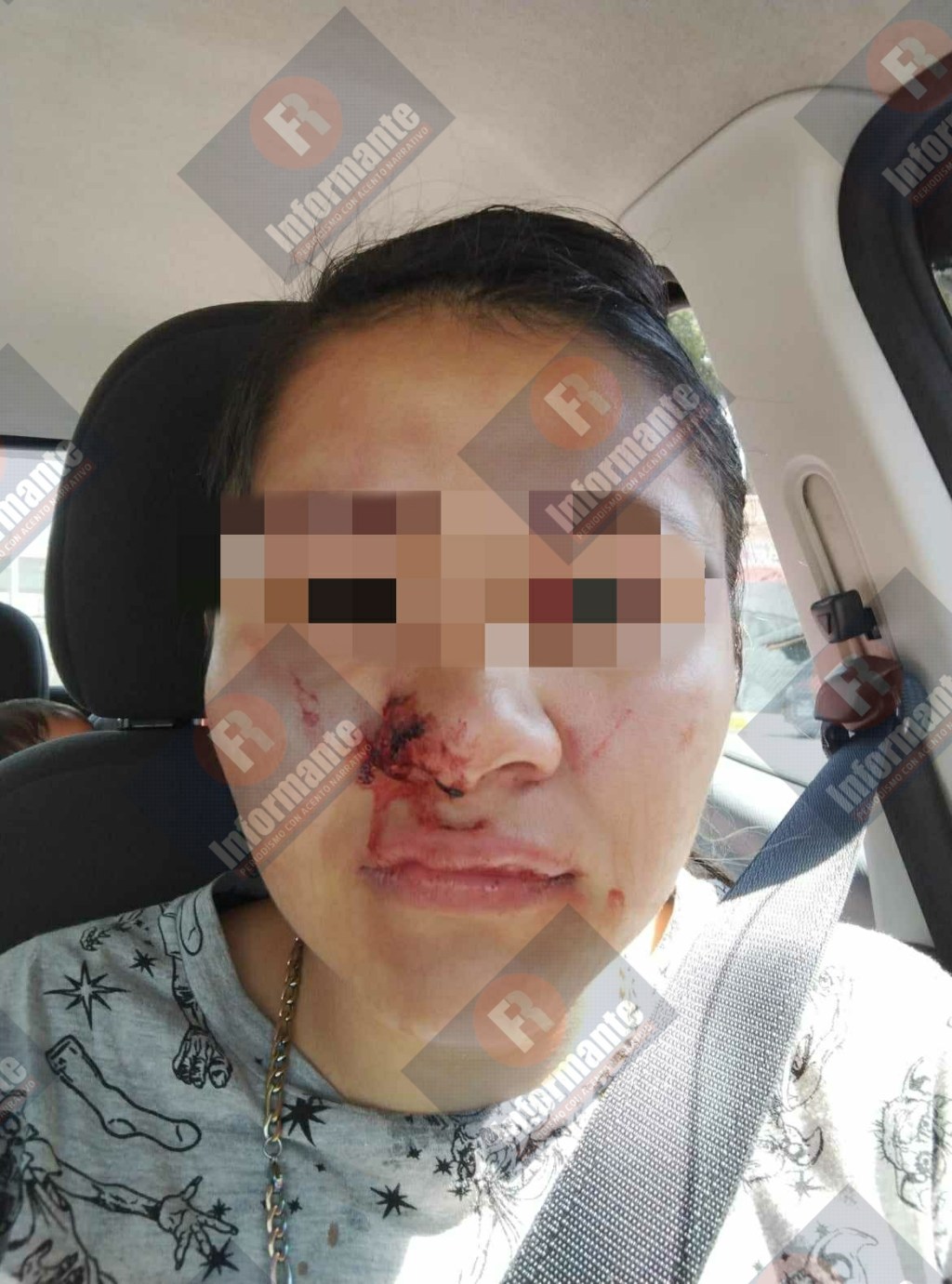 Denuncia: Golpean a jovencita para intentar robarle a su bebé en&nbsp;#SanMateoAtenco