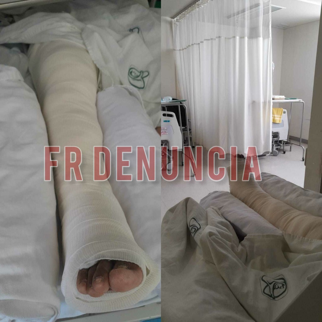 FR #Denuncia: Dejan sin cirugías a pacientes de la clínica 251 del IMSS por falta de&nbsp;insumos