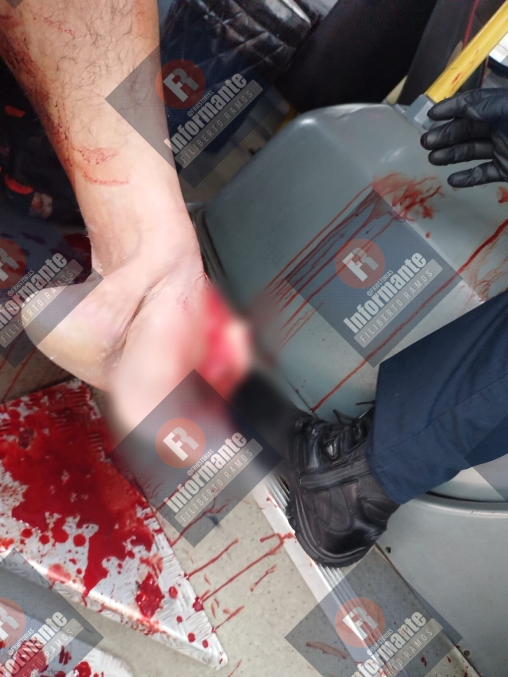 Camión atropella a un peatón al echarse de reversa en la terminal de&nbsp;#Toluca