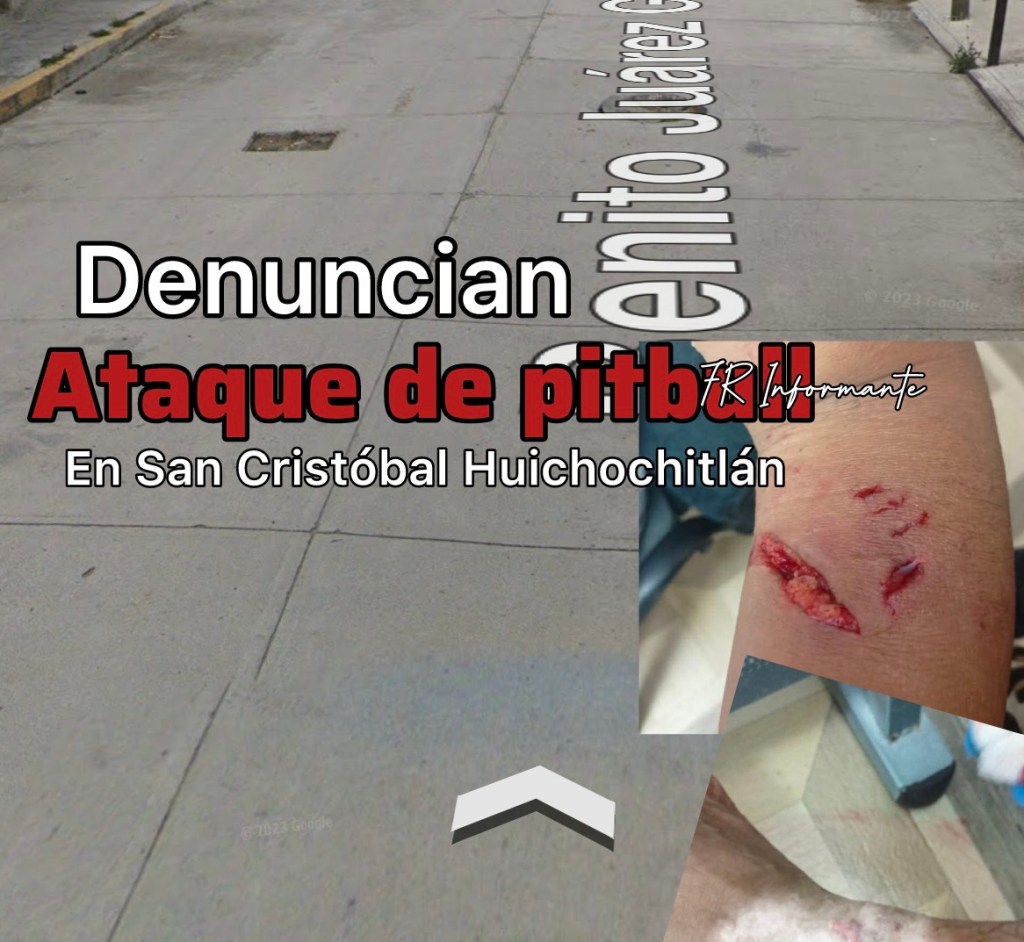 Denuncian nuevo ataqu3 de perros en zona norte de #Toluca; pitbull lesionó a un hombre en San Cristóbal&nbsp;Huichochitlán